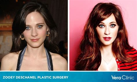 zooey deschanel plastic surgery|Zooey Deschanel Plastic Surgery: Separating Fact from Fiction.